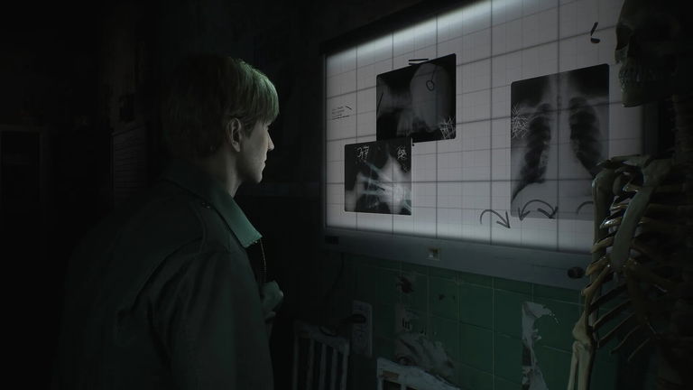 Silent Hill podría tener más remakes en desarrollo